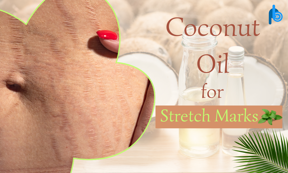 Uses of Coconut Oil for Reducing Stretch Marks