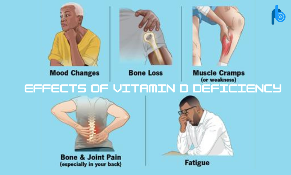  Effects of Vitamin D Deficiency